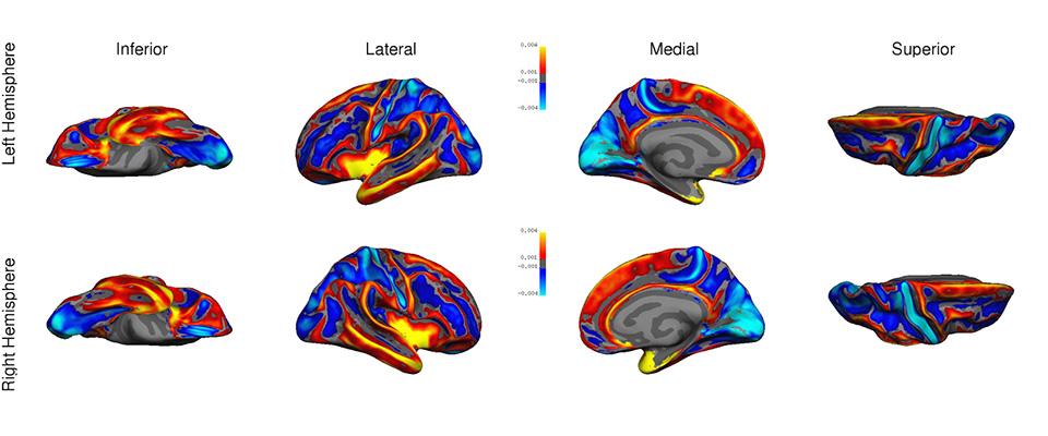 Cortical Thickness and ROI Analysis